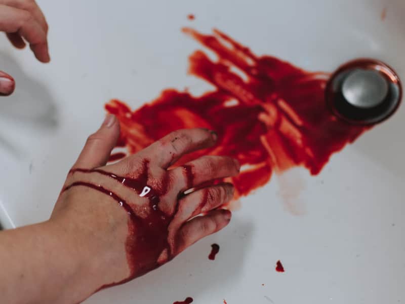 blood on hands